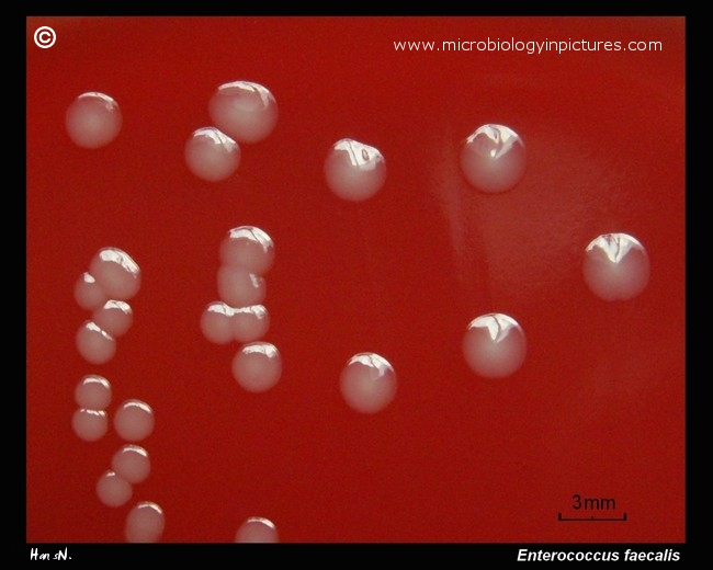 Enterococcus faecalis bacteria growing on blood agar, close-up